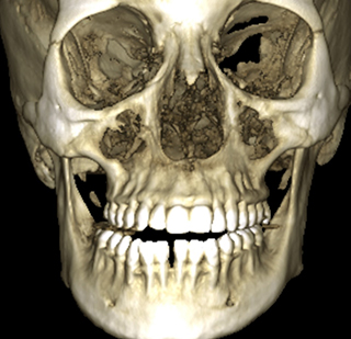 https://radiant3dxray.com/wp-content/uploads/2025/05/CBCT-Scan1.jpg